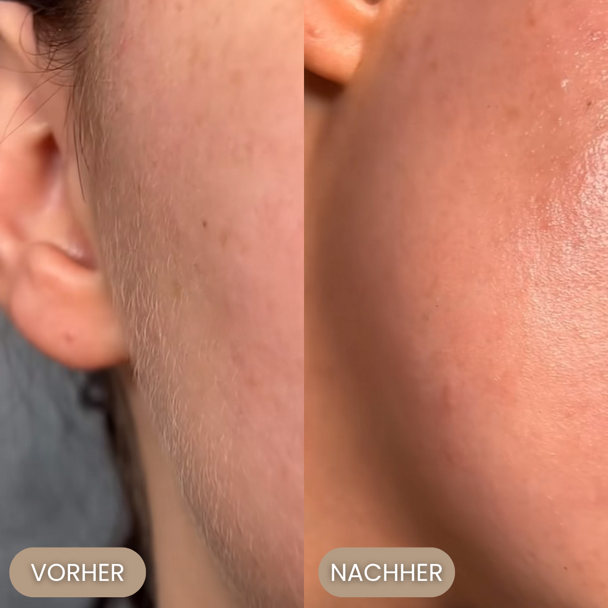 MyraDerm - Dein Smooth Skin Ritual!