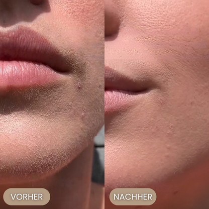 MyraDerm - Dein Smooth Skin Ritual!
