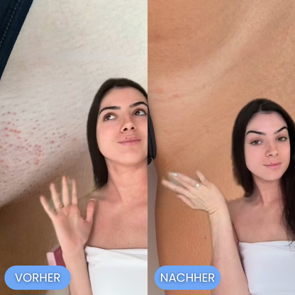 MyraHair - Weil rasieren sch**ße ist!