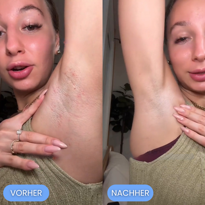 MyraHair - Weil rasieren sch**ße ist!
