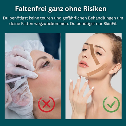 SkinFit