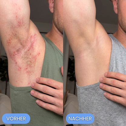 MyraHair - Weil rasieren sch**ße ist!!!